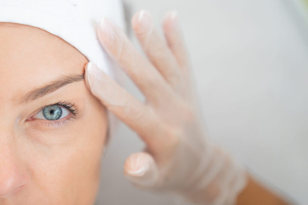 Face and Forehead Lift