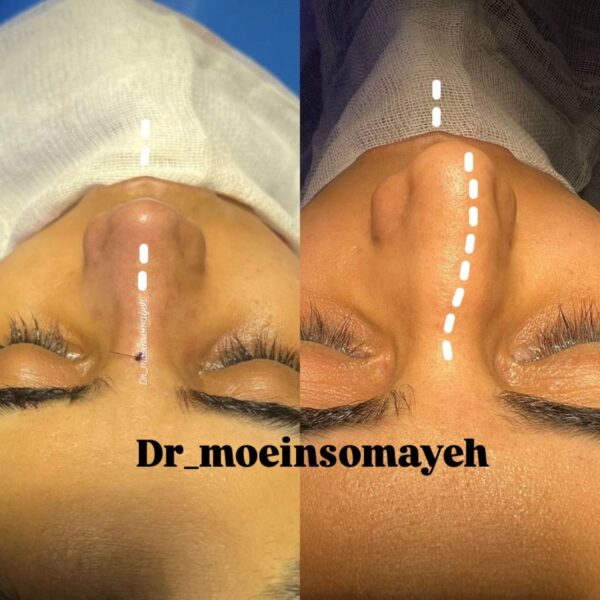 Face Surgery 1 600x600