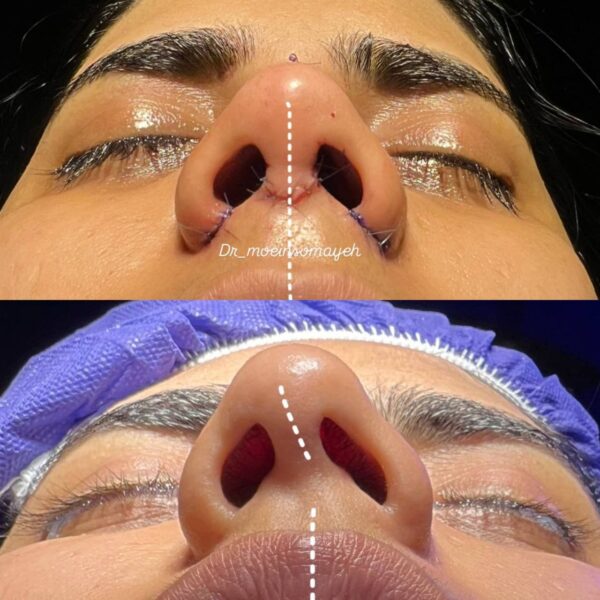 Face Surgery 2 600x600