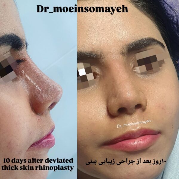 Face Surgery 3 600x600