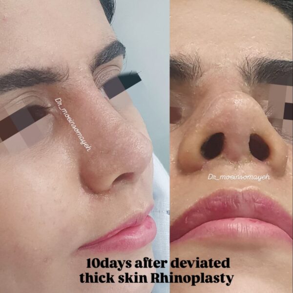 Face Surgery 4 600x600