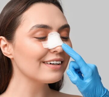 Rhinoplasty